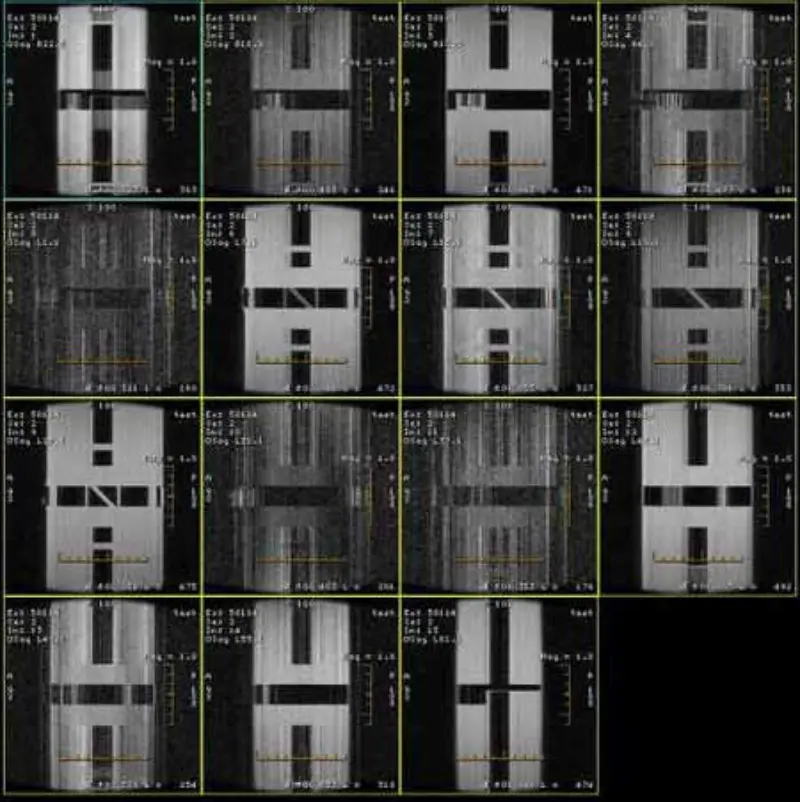 Артефакт FSE та GRE
